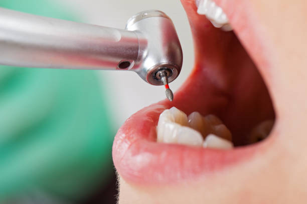 Best Root Canal Emergency Dentist  in Mercerville, NJ